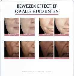 Eucerin Anti-Pigment Spotcorrector - Concealer - 5 Ml -Beauty Verkoop 1157x1200