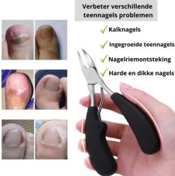 Merkloos Nageltang Voor Harde Teennagels - Manicureset Teennagelknipper - Teennagelschaar - Pedicure Set 11 Merkloos Nageltang Voor Harde Teennagels - Manicureset Teennagelknipper - Teennagelschaar - Pedicure Set -Beauty Verkoop 1196x1200 14