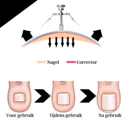 Merkloos STARMAN 7-delige Pedicure En Manicure Set - Nagelknipper - Pedicureset - Nagelvijl - Nageltang - Kalknagel - Teennagelknipper 16 Merkloos STARMAN 7-delige Pedicure En Manicure Set - Nagelknipper - Pedicureset - Nagelvijl - Nageltang - Kalknagel - Teennagelknipper -Beauty Verkoop 1200x1200 1039