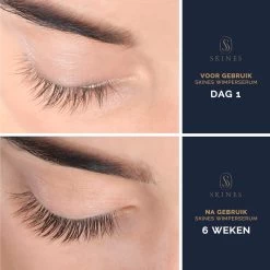Skines® Wimperserum Premium – Eyelash Serum - Wenkbrauw Serum - Wimper Groei - 3ML -Beauty Verkoop 1200x1200 413