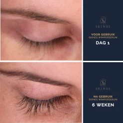 Skines® Wimperserum Premium – Eyelash Serum - Wenkbrauw Serum - Wimper Groei - 3ML -Beauty Verkoop 1200x1200 414