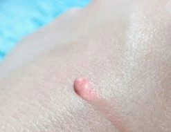 Biodermal Sun Lipbalm SPF25 - Tube 12 Ml - Natural Pink - Lippenbalsem -Beauty Verkoop 1200x927 1